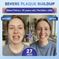 🦷 Tideglusib Sneloplossende Tand- & Tandvleesherstel Orale Strips ✨