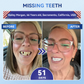 🦷 Tideglusib Sneloplossende Tand- & Tandvleesherstel Orale Strips ✨
