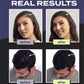 💇‍♀️Haarvezelset voor dun haar en kale plekken.