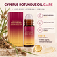 📢📢 50% KORTING!!🌸 Roll-on na het ontharen – rollerball voor gericht aanbrengen, lichte niet-vette formule & hydrateert direct. 50 ml, overal mee naartoe! ✨🧴