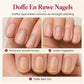 📢📢 1+1 gratis💅 Natuurlijke roze nagelrichelvuller  – verjongende gladmakende coating | verbergt direct verticale nagelrichels voor glanzende, gezonde nagels